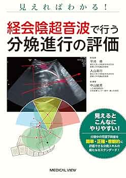 mochi　内科外科　産婦人科　REVIEW BOOK 分娩進行がみえる！ 経会陰超音波を用いた産科内診技術: 中山